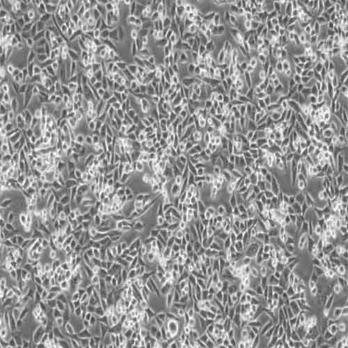 4T1 (小鼠乳腺癌细胞)